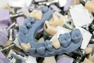 Dental illustration of a service