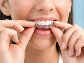 Teeth Whitening
